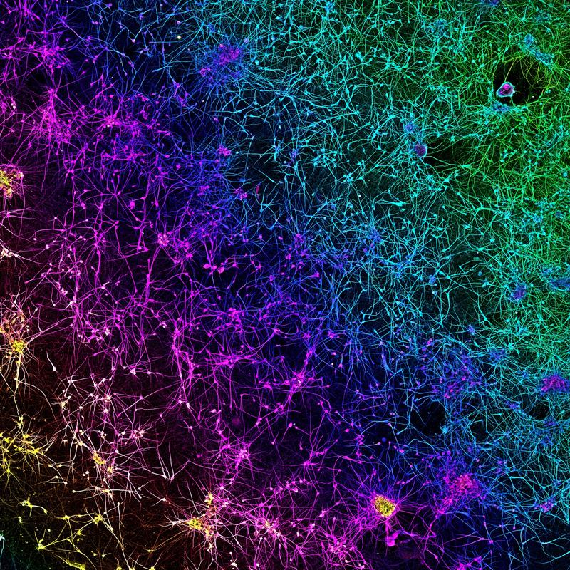 dopamine network