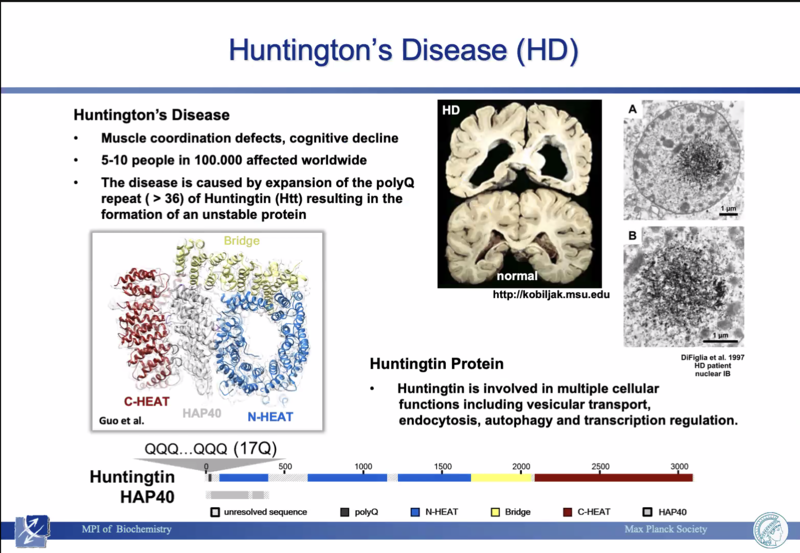Huntington Disease Slide from the Presentation