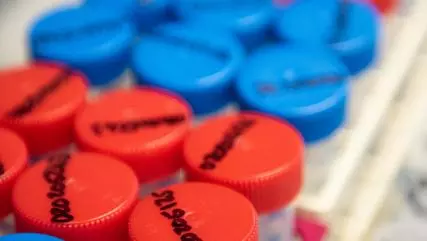 Close up of sample tubes, some with red lids and others with blue lids. They have been labelled on the lids with black marker.