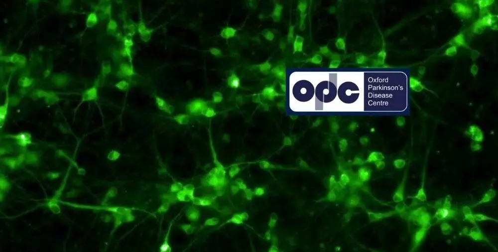image of the human dopamine neurons grown from stem cells in the laboratory.