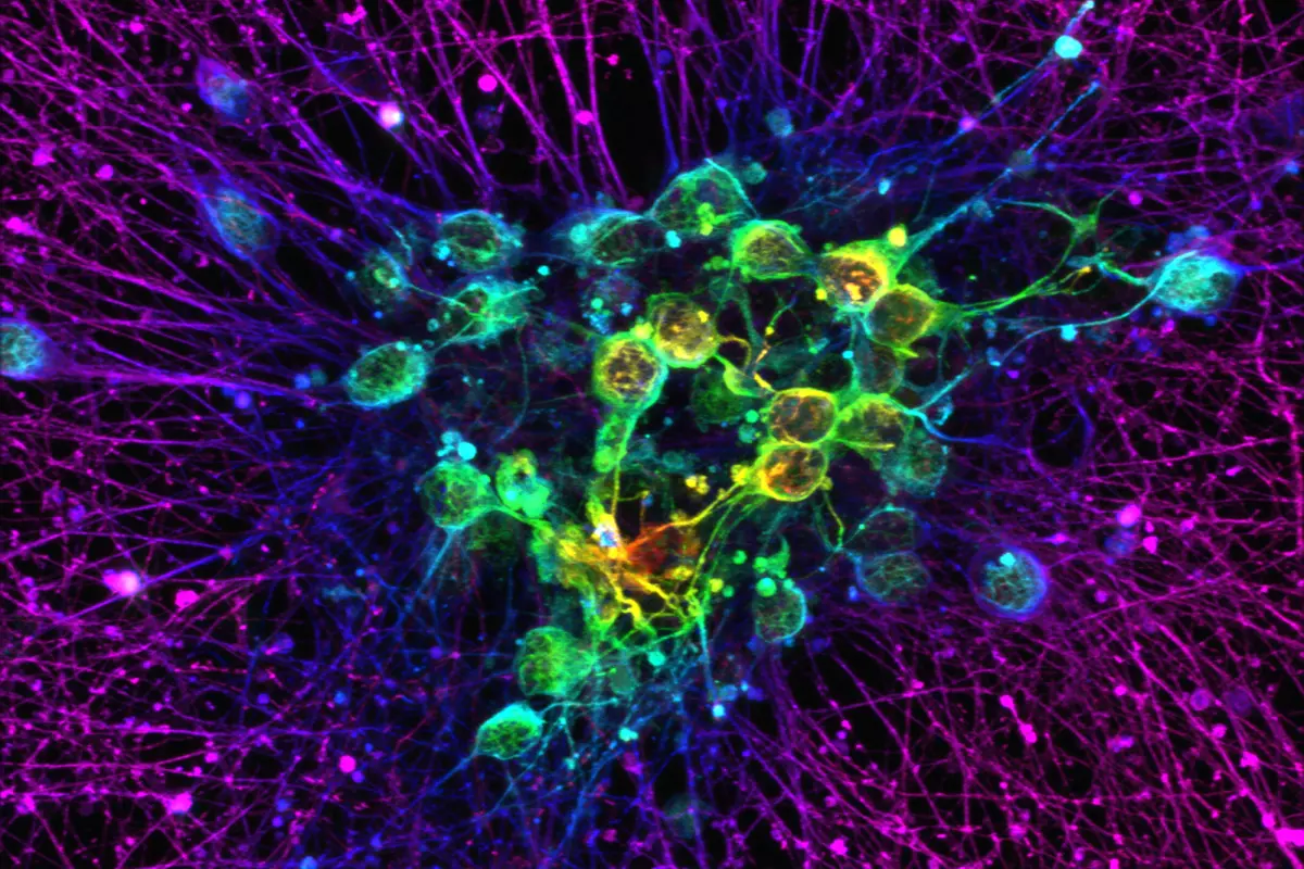 Fluorescence microscopy image of a dense neural network, with branching fibres glowing magenta and purple around clustered cells highlighted in green, yellow and cyan against a black background.